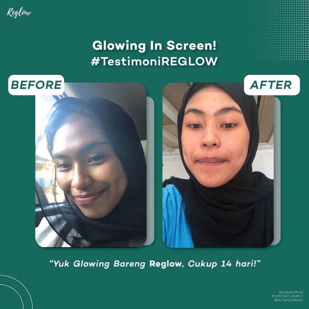 BISA COD/BAYAR DITEMPAT PAKET REGLOW GLOW SKIN TREATMENT CREAM WAJAH TONER FACIAL WASH SKINCARE DR SHINDY PUTRI ORI 100% BPOM HALAL AMAN UNTUK BUMIL BUSUI COCOK UNTUK SEMUA JENIS KULIT KUSAM KERING BERMINYAK BERJERAWAT SENSITIF ANTI AGING