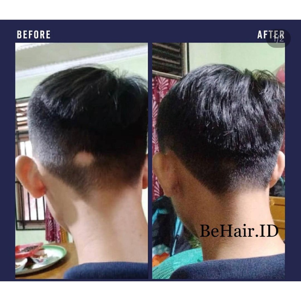 TERLARIS Serum Liquid BIOFINMIX BeHaird.ID BOURN BEARD Finmix Cave Biotin Finasteridee Minoxidil 5% BeHairId Penumbuh Jambang Kumis Alis Rambut Brewok Mencegah Kerontokan Kebotakan Uban ketombe ASLI ORIGINAL 100% Serum Beard OIL Penumbuh Brewok