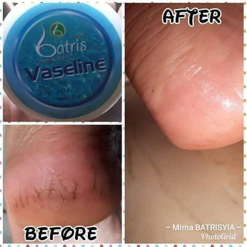 ( BISA COD ) VASELINE UNTUK KAKI PECAH PECAH/ CREAM TUMIT AMPUH/ CREAM KAKI PECAH PECAH