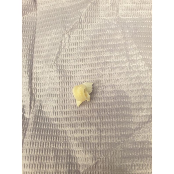 gigi asli praktikum FKG gigi molar sulung pedo anak