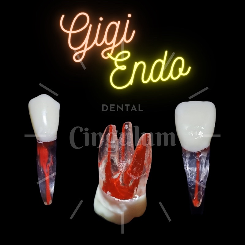 Jual Gigi Endo / Gigi Endodontik / Gigi Saluran Akar Shopee Indonesia