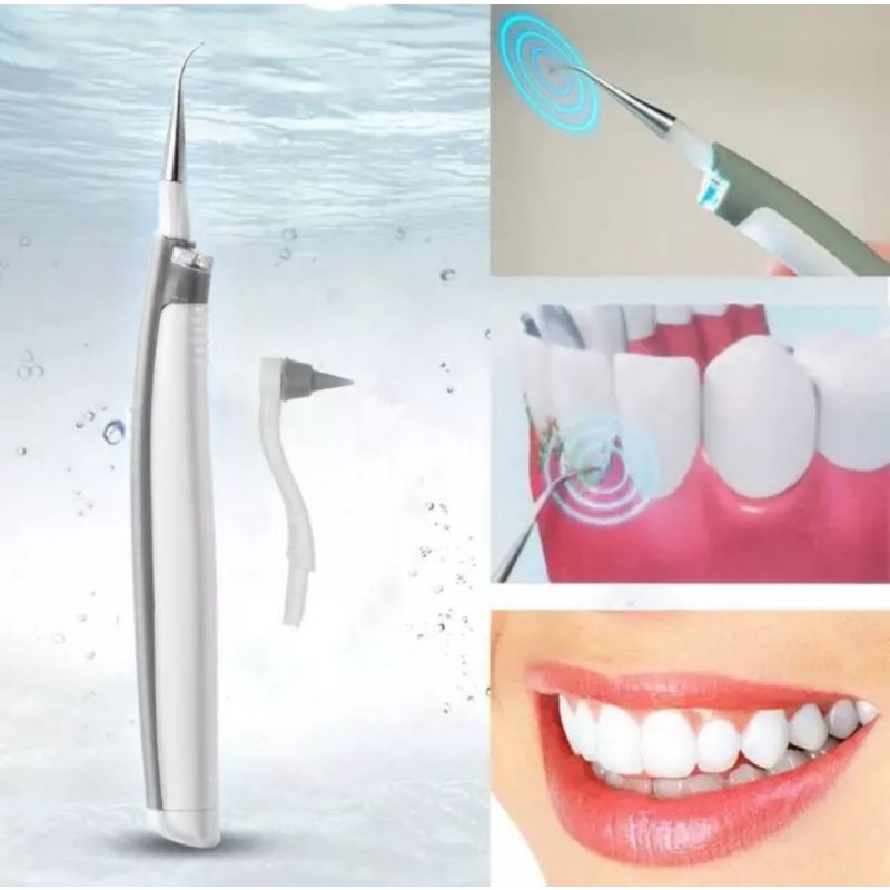 Alat Pembersih Karang Gigi Penghilang Plak Elektrik / Alat Pembersih Plak Gigi Ultra Sonic