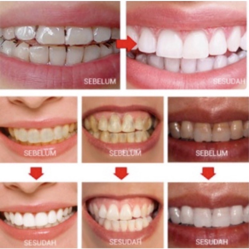 BREYLEE TEETH WHITENING POWDER 55G-30G