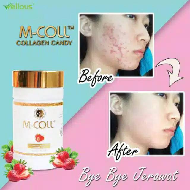 MCOLL ISI 60 BUTIR M-COLL COLLAGEN CANDY  ORIGANAL 100% TERPERCAYA