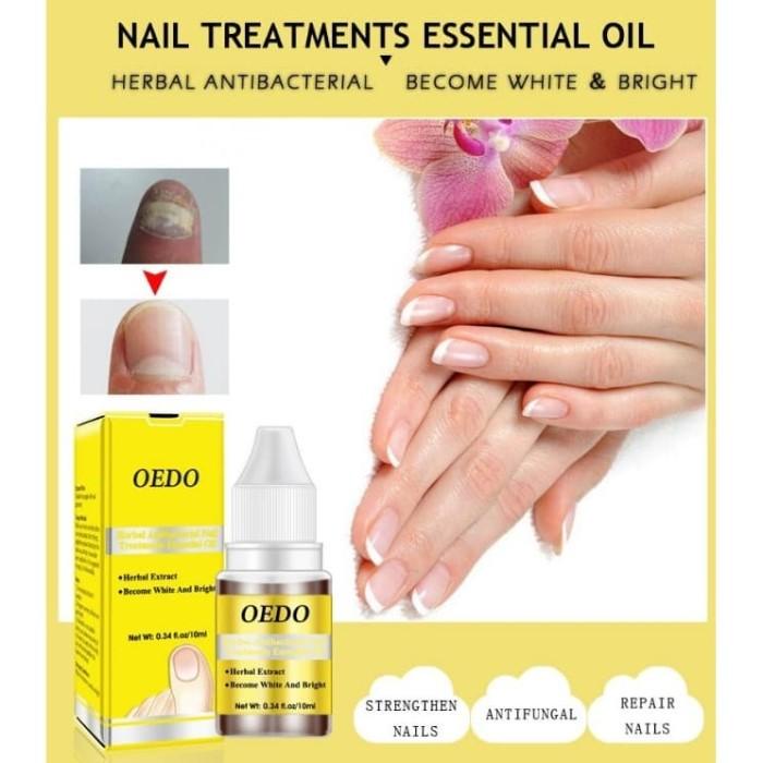 Miny | Ori Oedo Perawatan Kuku Dan Jamur Kuku
