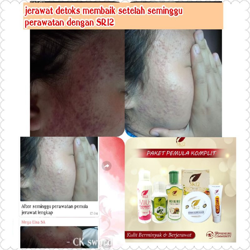 PAKET PEMULA SR12 KOMPLIT / PERAWATAN SKINCARE AMAN &amp; ALAMI / PENETRAL KULIT / PAKET PERAWATAN WAJAH