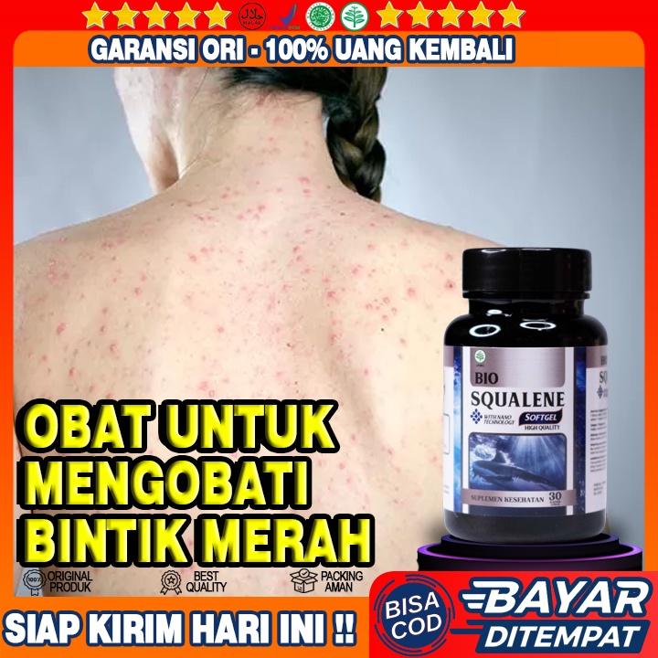 Obat Untuk Mengatasi Bintik Merah Pada Kulit - Obat Gatal Gatal Seluruh Badan - Muncul Bintik Bintik