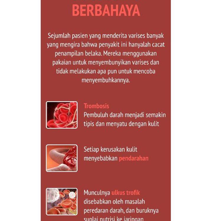 VARIKOSE ORIGINAL VARIKOSE 100% ASLI CREAM ATASI VARISES - ECK MARK TERBAIK AMPUH DAN CEPAT U1V0
