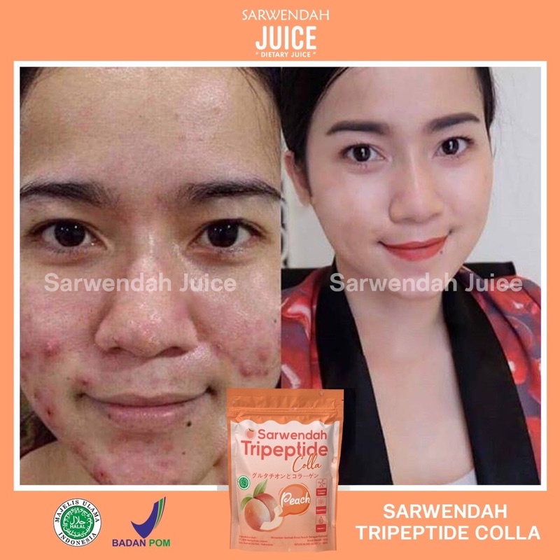 TRIPEPTIDE COLLA PEACH POUCH / COLLAGEN PEACH MENCERAHKAN BADAN WAJAH / MEMUDARKAN BEKAS LUKA SECARA ALAMI / ANTI AGING / WHITENING BOOSTER COLLAGEN