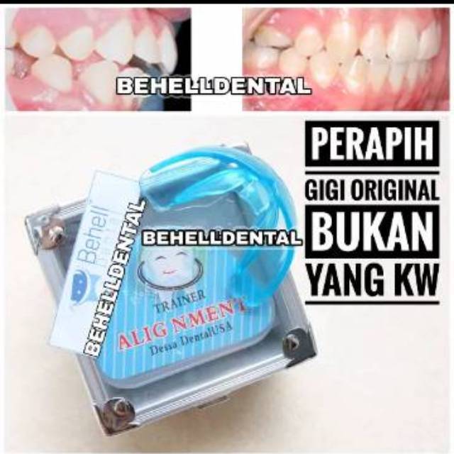 PERAPIH GIGI BEHELLDENTAL ORIGINAL / ALAT PELURUS TANPA BEHEL / TEETH TRAINER RETAINER ALIGNMENT 100% ORI ASLI - Dental Perata Gigi