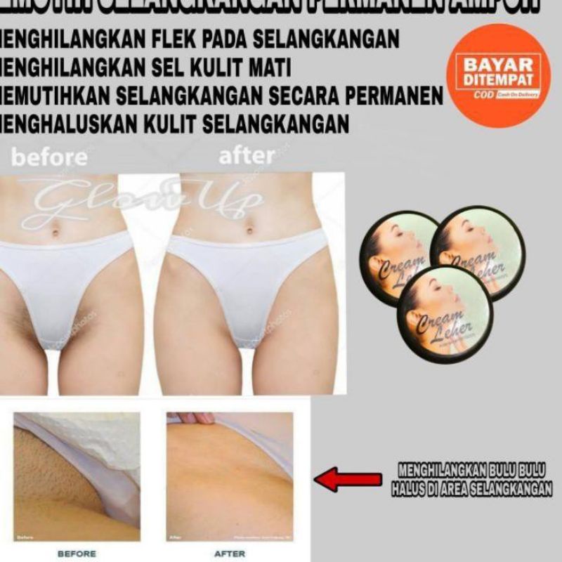 Cream Pemutih Leher Selangkangan Ketty Ampuh Perontok Daki