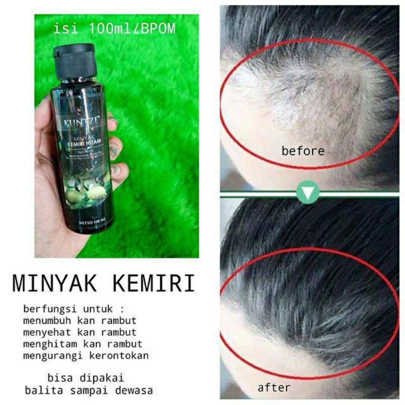 Minyak kemiri perawatan rambut rontok / Minyak kemiri anti botak / Kuntze minyak kemiri / Minyak kemiri penyubur rambut / Penumbuh rambut / Minyak kemiri hitam original BPOM