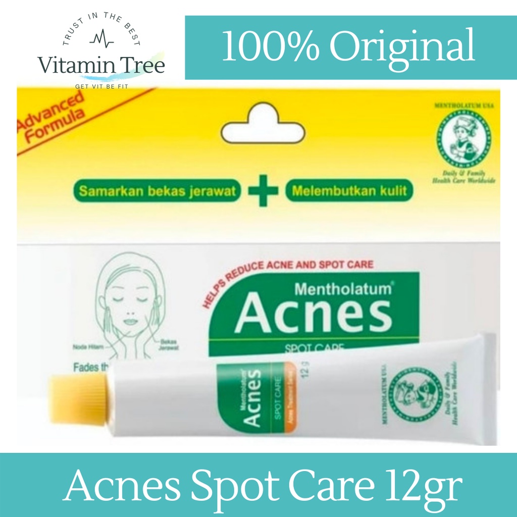 Jual Acnes Spot Care / Obat Jerawat / Acnes Treatment Series | Shopee