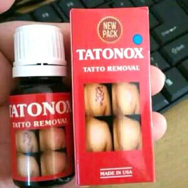 Tatonox tatonox penghilang tato