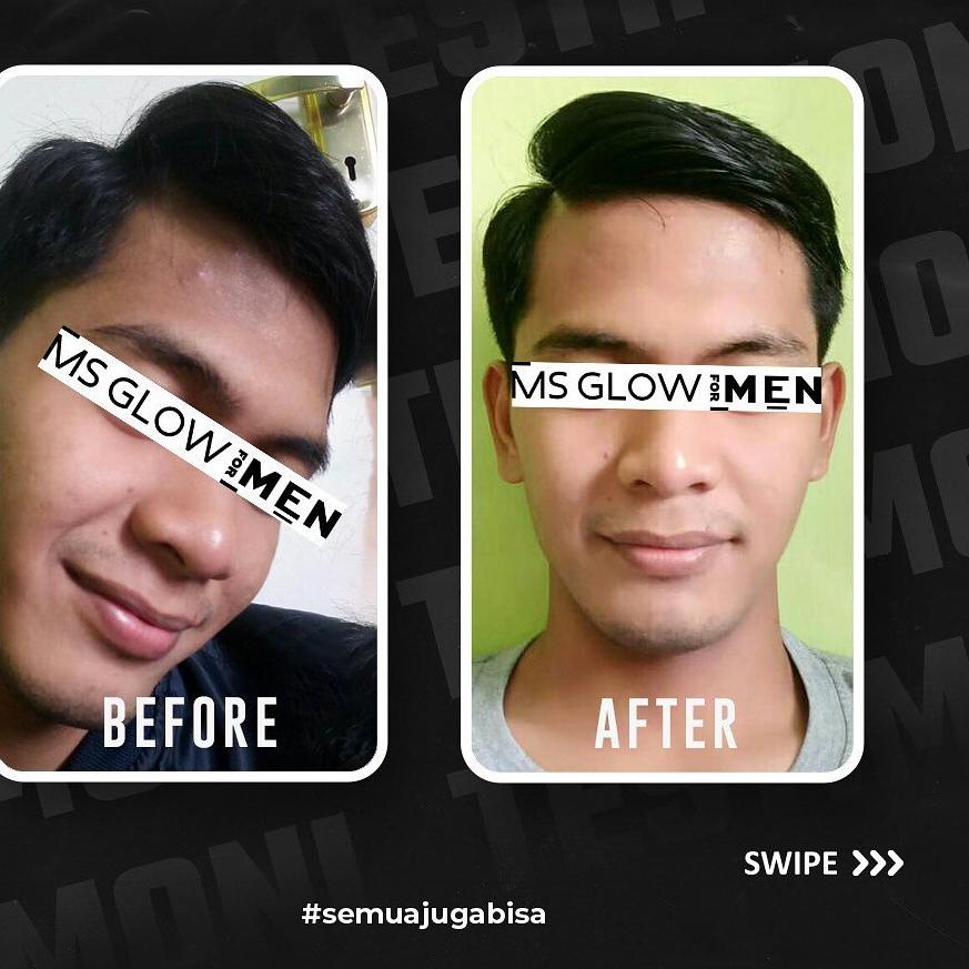 Persediaan Terbatas➜ MS Glow For Men Man Original - Paket Basic Lengkap Facial Wash Sabun Cuci Muka Cream Serum Sunscreen Spray Acne Pria Cowok MS Glow For Men Man - Msglow men AT65