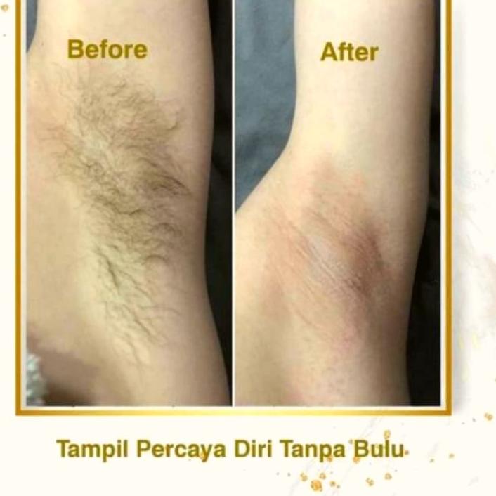 ⇼ Sugar wax / cold wax / pencabut bulu / miracle waxing / honey waxing / penghilang bulu ヲ