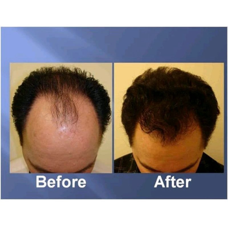 BMKS MINYAK KEMIRI RAMBUT/penumbuh rambut/kemiri oil