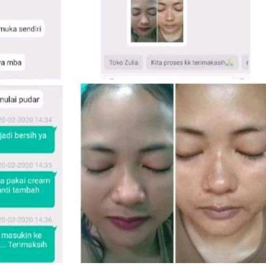 ✲ Flek dr Liz / Lis night Cream / Liz night whitening / saleb flek Lis skincare Ω