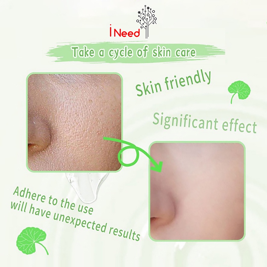 (INEED) [BPOM] GIRLPAL Centella Asiatica Peeling Gel - Aloe Vera Gel - CHARCOAL 100GR