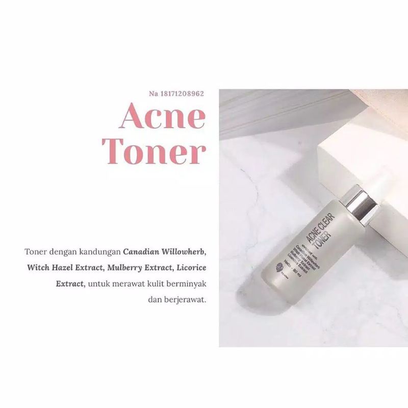 Toner Acne MS Glow 100% original skicare toner wajah wanita termurah (bisa cod)