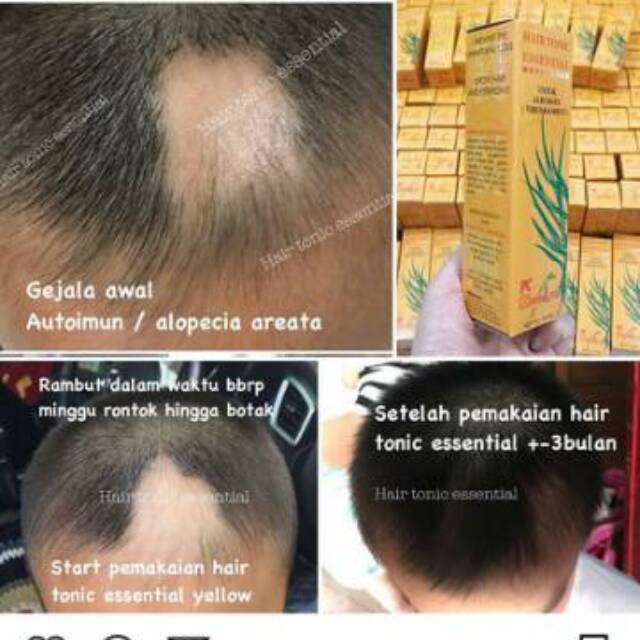 Hair tonic essential