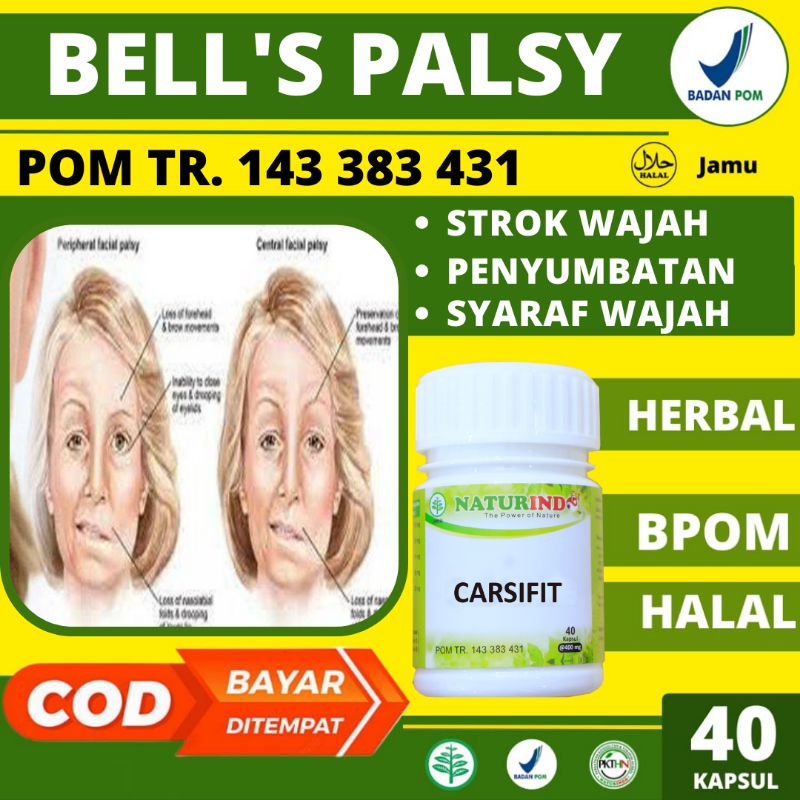 Obat Herbal Bells Palsy Ampuh Penyumbatan Syaraf Wajah Susah Bicara Otot Wajah Tidak Simetris