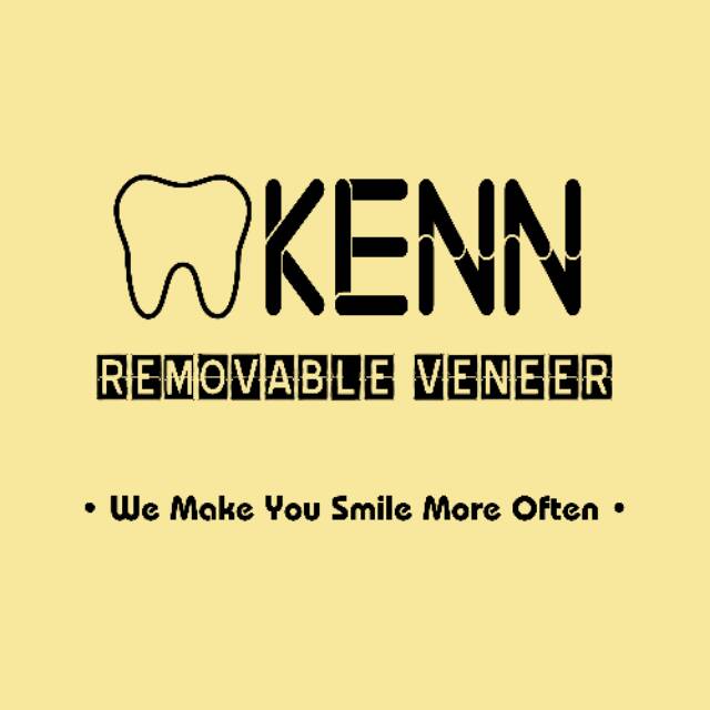kennremovableveneer