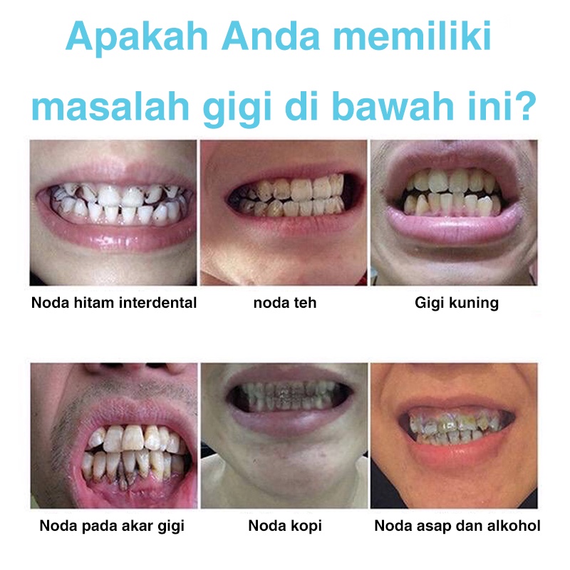 [COD]Pemutih Gigi Kuning Kerak Penghilang Karang Permanen Original Ampuh Teeth Whitening Menghapuskan plak gigi dan noda asap menghapuskan bau mulut