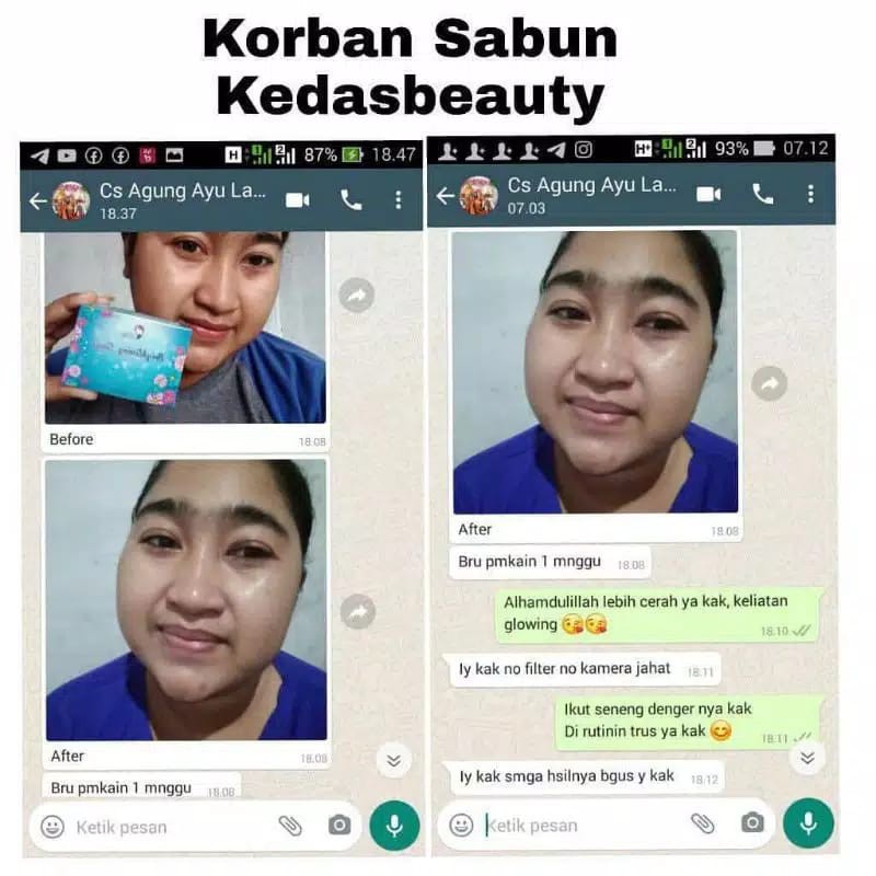 Promo Sabun Kedas Beauty 100% Original (COD dan Free Ongkir&amp;Free Gift) KEDAS SOAP