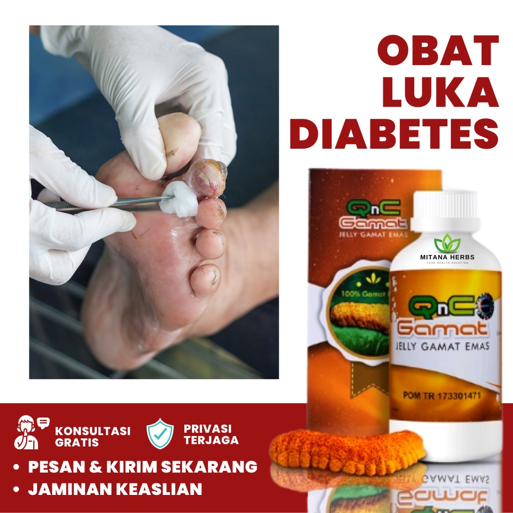 Mitana Herbal, Obat Luka Diabetes Agar Cepat Kering, Obat Luka Diabetes Basah, Obat Luka Diabetes Be