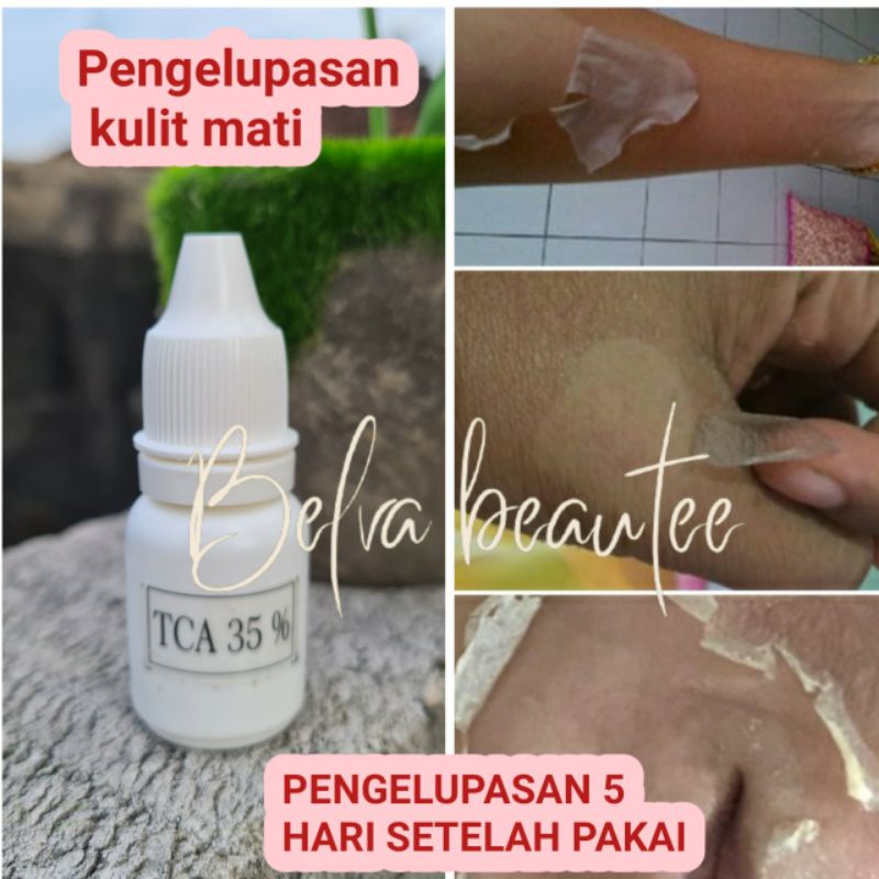 PENGELUPASAN BADAN SEL KULIT MATI / Peeling / TCA