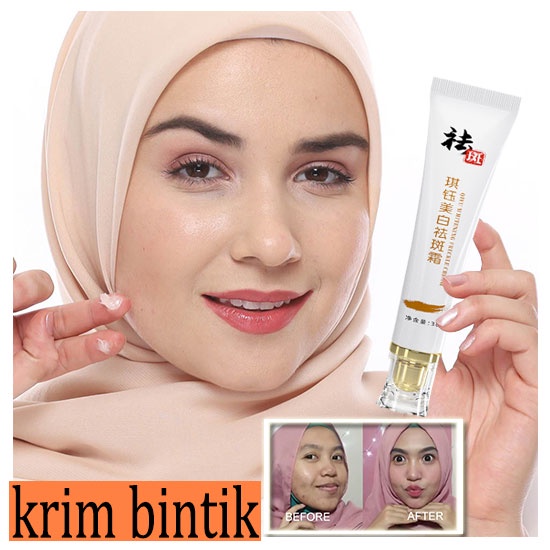 【Barang spot】Krim pemutih krim bintik penghilang flek hitam Salep Flek Hitam Melasma Ampuh Remedy Black Spots Remedy 30g Penghapusan Bintik Hitam Penghapusan Bekas Jerawat yang Efektif Dapat digunakan saat menyusui