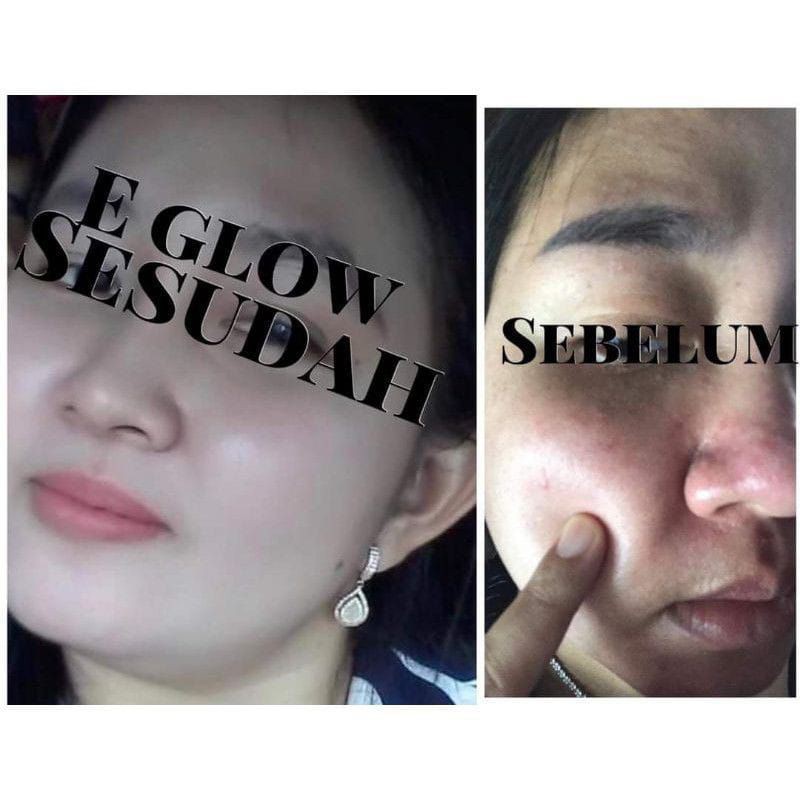 PAKET EGLOW PLATINUM KEMASAN TERBARU ORIGINAL 100% RESMI / Whitening series / Acne series / Menghaluskan Wajah / Kinclong