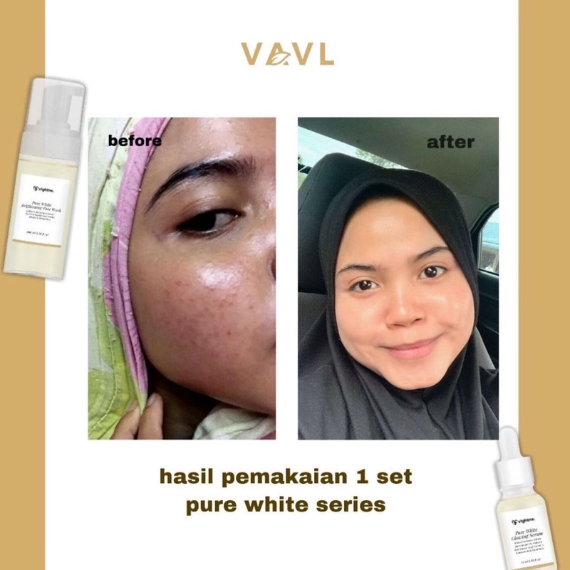 VAVL Pure White Glowing Serum Brightening 15ml BPOM - Serum Wajah,Serum Pencerah Wajah,Serum Glowing