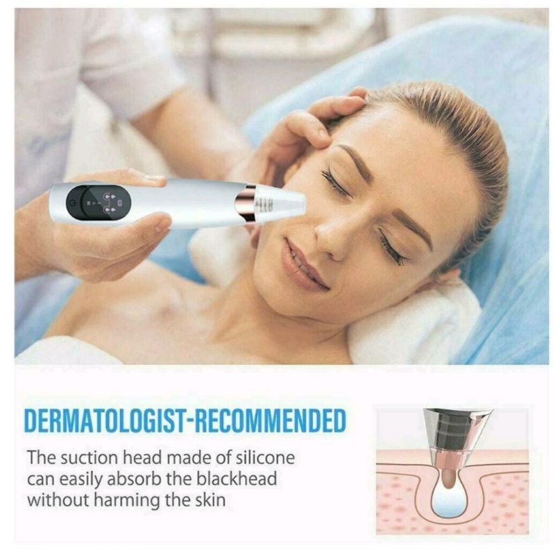 Alat Pembersih dan Penyedot Komedo / Alat Vakum Komedo / Alat Sedot Komedo / Blackhead Remover / Alat Facial Komedo / Alat Pembersih Komedo Praktis / Alat Menghilangkan Komedo Ampuh / Alat Penyedot Komedo / Alat Pembersih Wajah / Alat Membersihkan Komedo