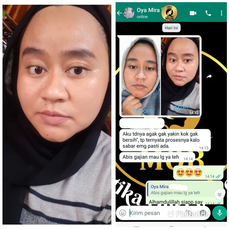 PAKET MQBeauty Brightening Series [free red jelly + cream jerawat] Skincare BPOM - MQ Beauty Krim Perawatan Wajah [ORIGINAL] 1 [ BAYAR DITEMPAT] [ASLI]-8
