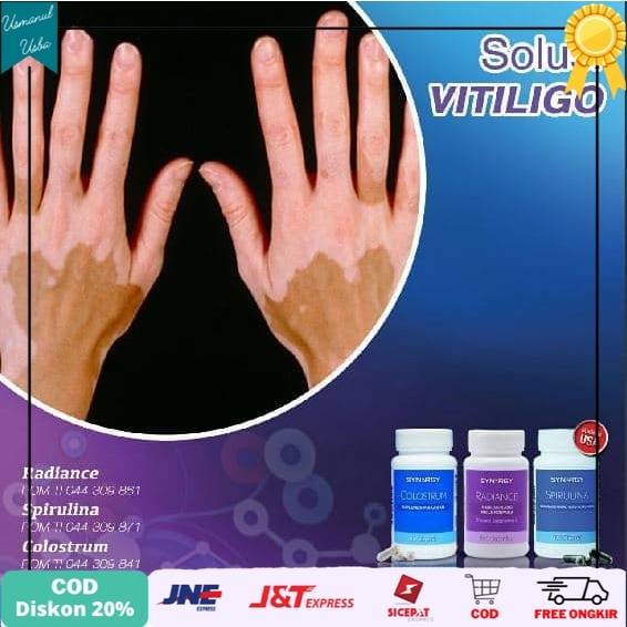 

❤COD❤ Paket Penyembuhan Vitiligo / Hilangnya Pigmen Kulit