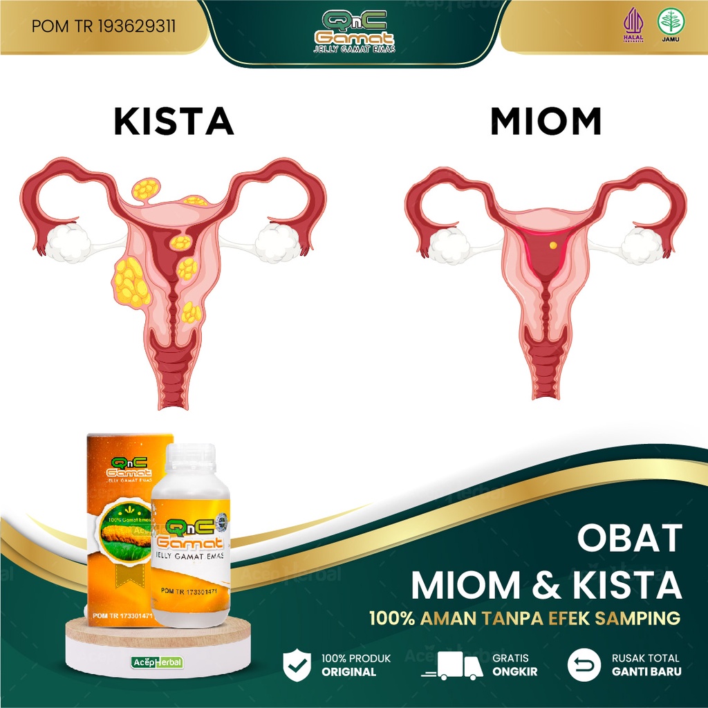 Jual Obat Miom And Kista Benjolan Dinding Rahim Dan Bibir Vagina Ovarium