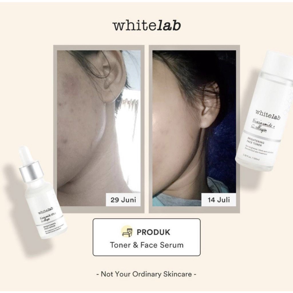 Whitelab Brightening Face Toner 100ml