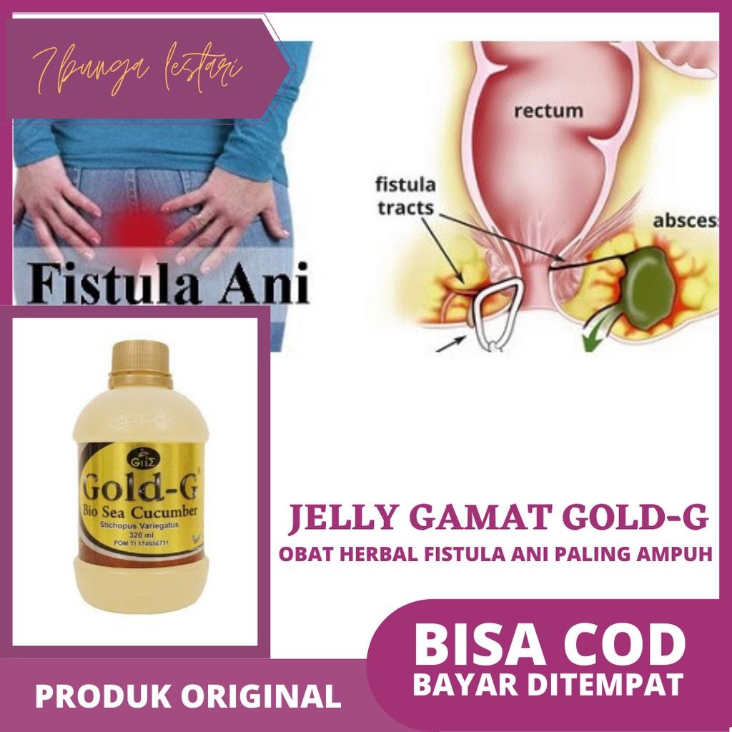 REAKSI CEPAT Obat Fistula Ani di Apotik |  Obat Antibiotik Untuk Fistula Ani | Obat Fistula Ani Tanp