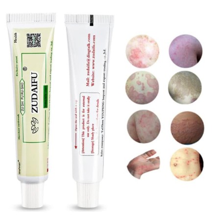 Zudaifu Salep Gatal Gatel Alergi Kulit Eksim Kurap Jamur Original-2