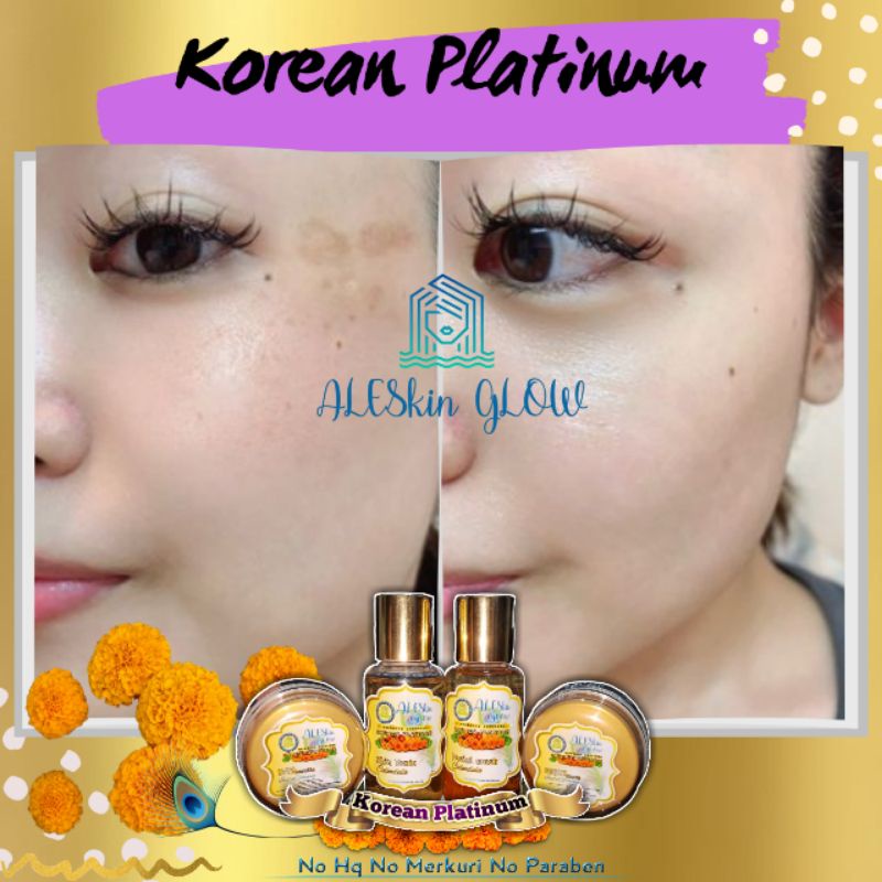 KOREAN PLATINUM ALESKIN GLOW Skincare Glowing-Paket Perawatan Wajah Korea-Cream Glowing