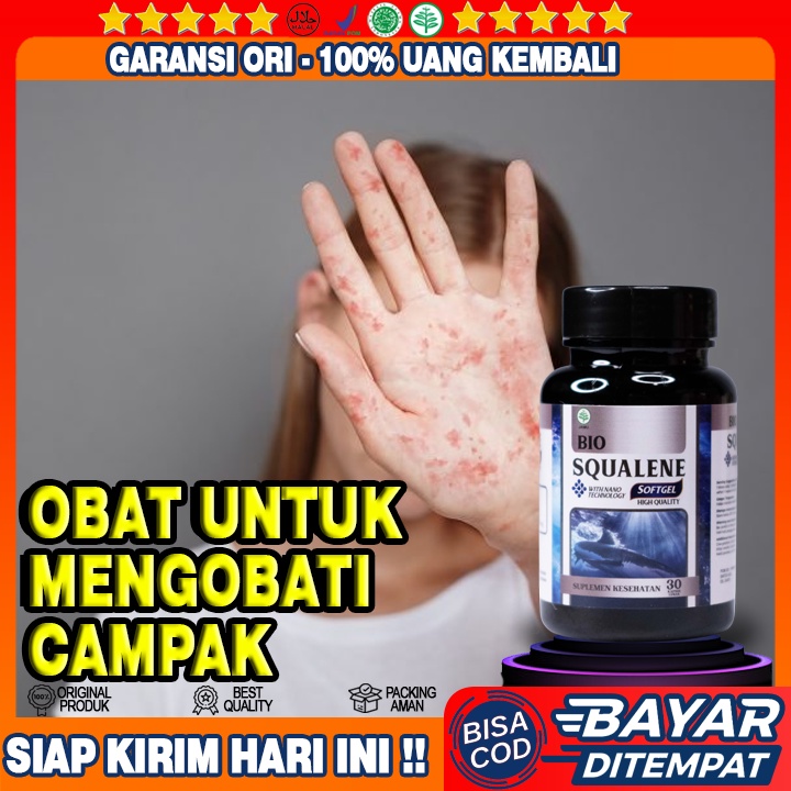 Obat Campak Rubella - Obat Ruam - Obat Bintik Bintik Merah Dikulit - Obat Penyakit Campak - Obat Sak