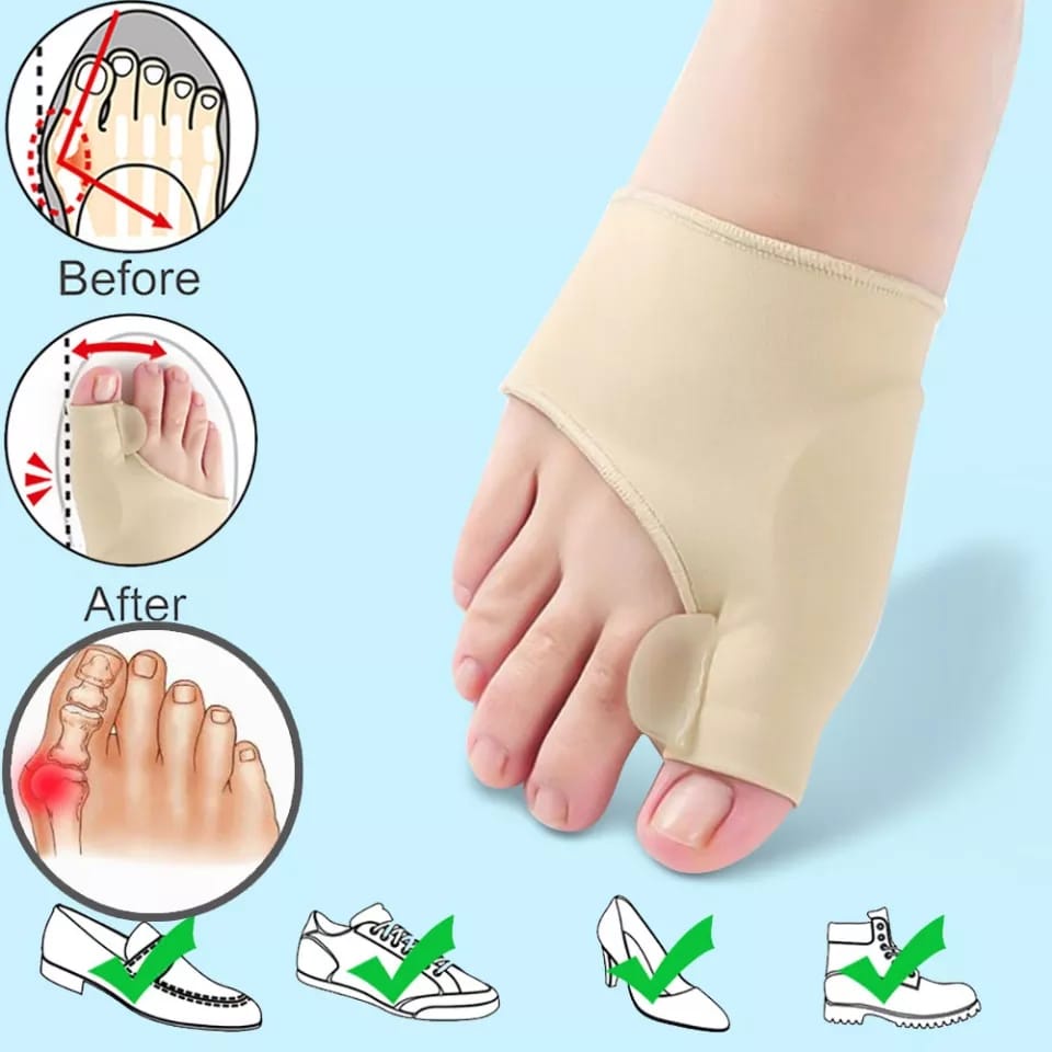 1 Pasang Corrector Bunion Hallux Orthotic Insole / Gel Kain Lembut Pelindung Jempol Jari Kaki