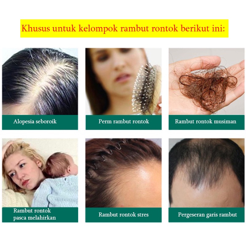 Hair growth serum spray Anti tonik rambut rontok Pertumbuhan rambut cepat 20G Serum Pemanjang &amp; Penumbuh Rambut tercepat No1 Di Indonesia