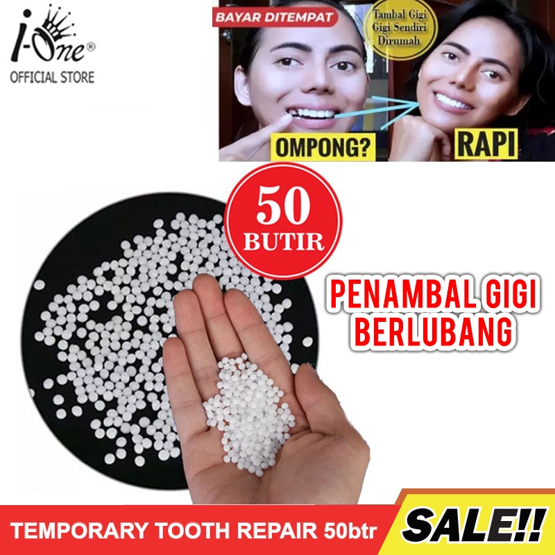 (50 BUTIR) GIGI PALSU SEMENTARA PENAMBAL GIGI PATAH RENGGANG TEMPORARY TOOTH TEMPTOOTH GINGSUL PATAH
