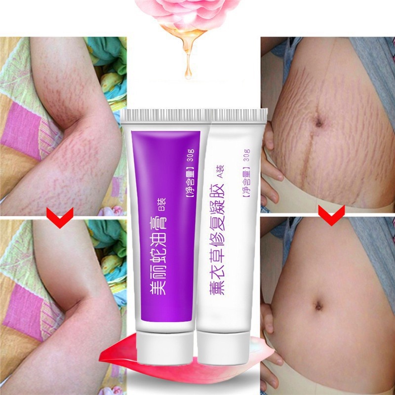 Krim Cream Salep penghilang luka bekas Menghilangkan stretch mark Penghilang bekas luka yang ampuh Memperbaiki bekas luka bakar Bekas Jerawat Bekas luka lama Benjolan dan jerawat