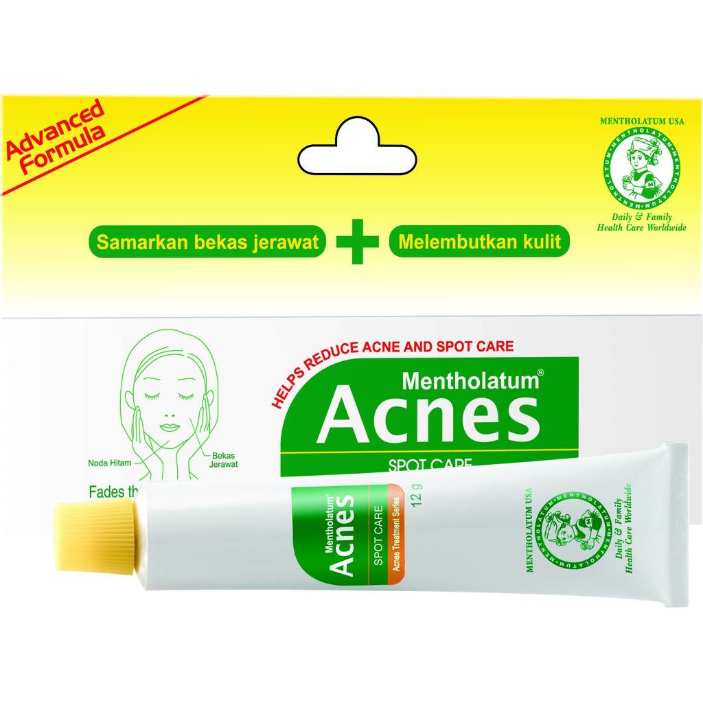 Acnes Spot Care 12g Acne Gel Penghilang Bekas Jerawat Acne Treatment Acne Care Shopee Indonesia