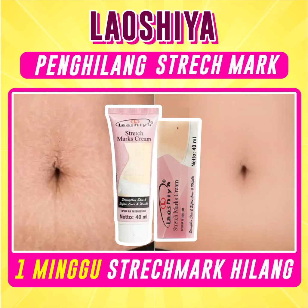 Laoshiya Strecth Mark Cream Laoshiya Penghilang Strechmark Penghilang Bekas Luka Penghilang Keloid Selulit