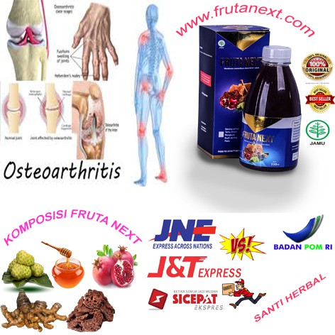 FRUTANEXT Obat Pengapuran Tulang Ekor Lutut Berbunyi, Dengkul Kopong, Penyakit Osteoarthritis